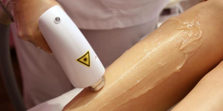 Лазерная или IPL-эпиляция: что лучше?