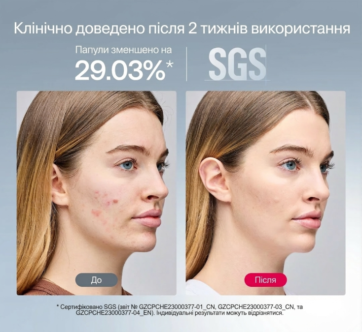 LED-маска Ulike ReGlow для фототерапии и обновления кожи лица