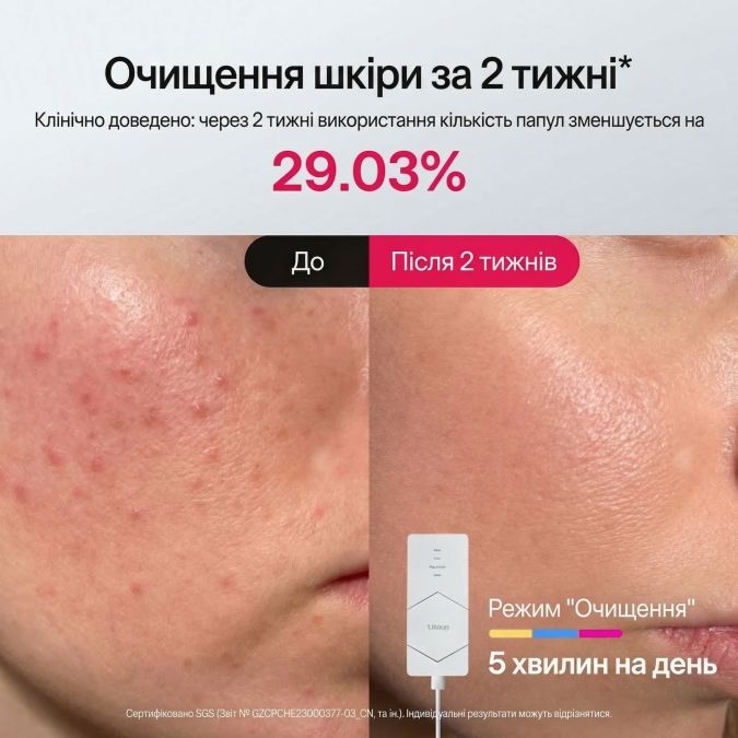 LED-маска Ulike ReGlow для фототерапии и обновления кожи лица